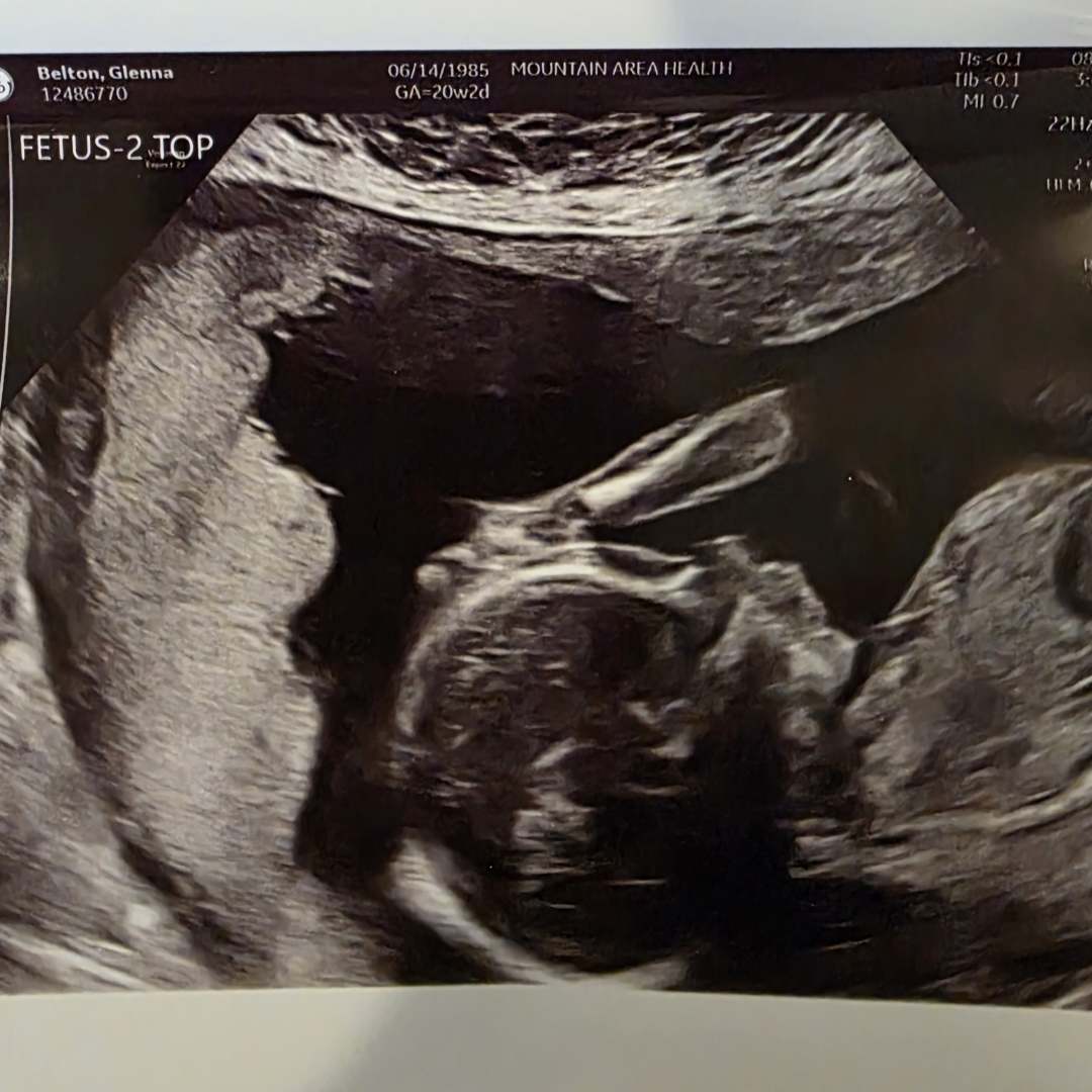 Photo shared by Glenna for their Babylist baby registry.
