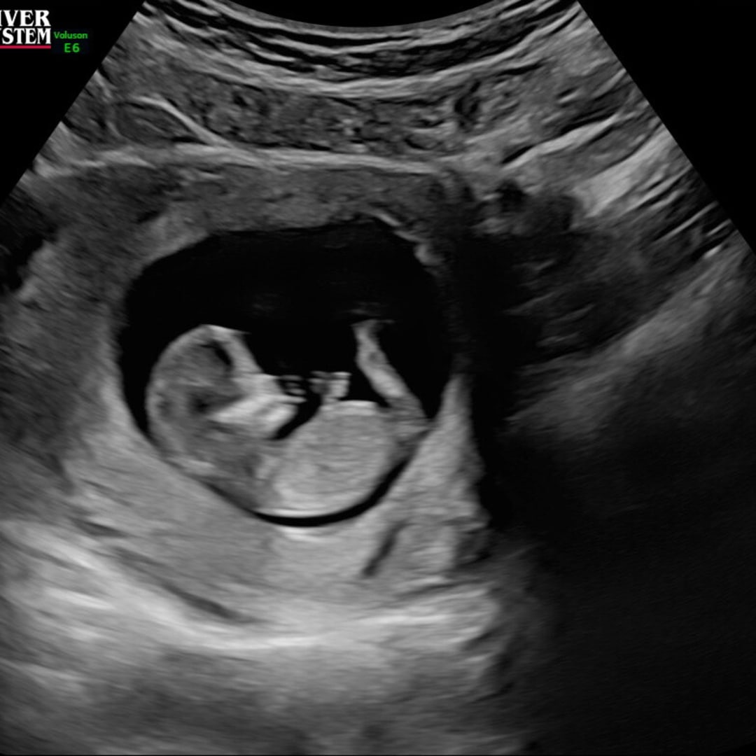 Photo shared by Laken for their Babylist baby registry.