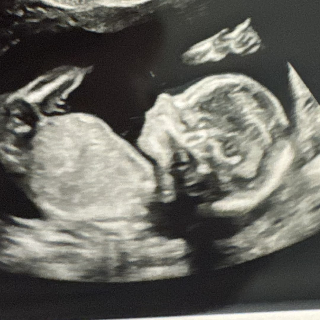 Photo shared by Taylor for their Babylist baby registry.