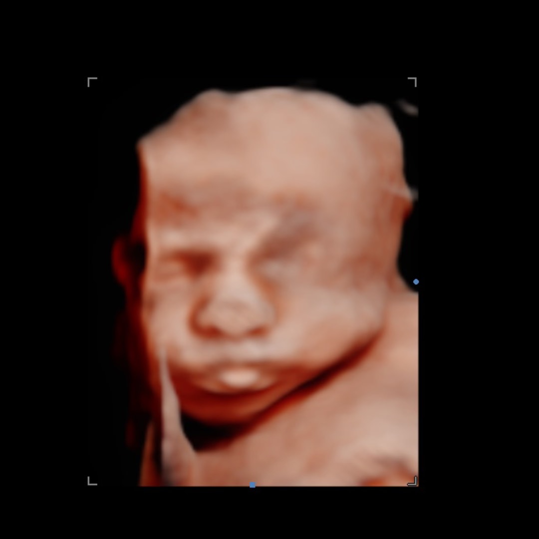 Photo shared by Grace for their Babylist baby registry.