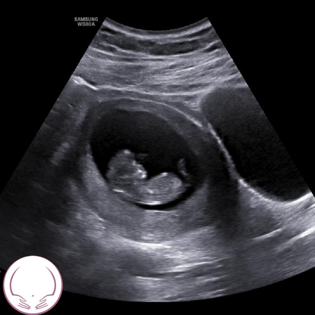 Photo shared by Desiree for their Babylist baby registry.