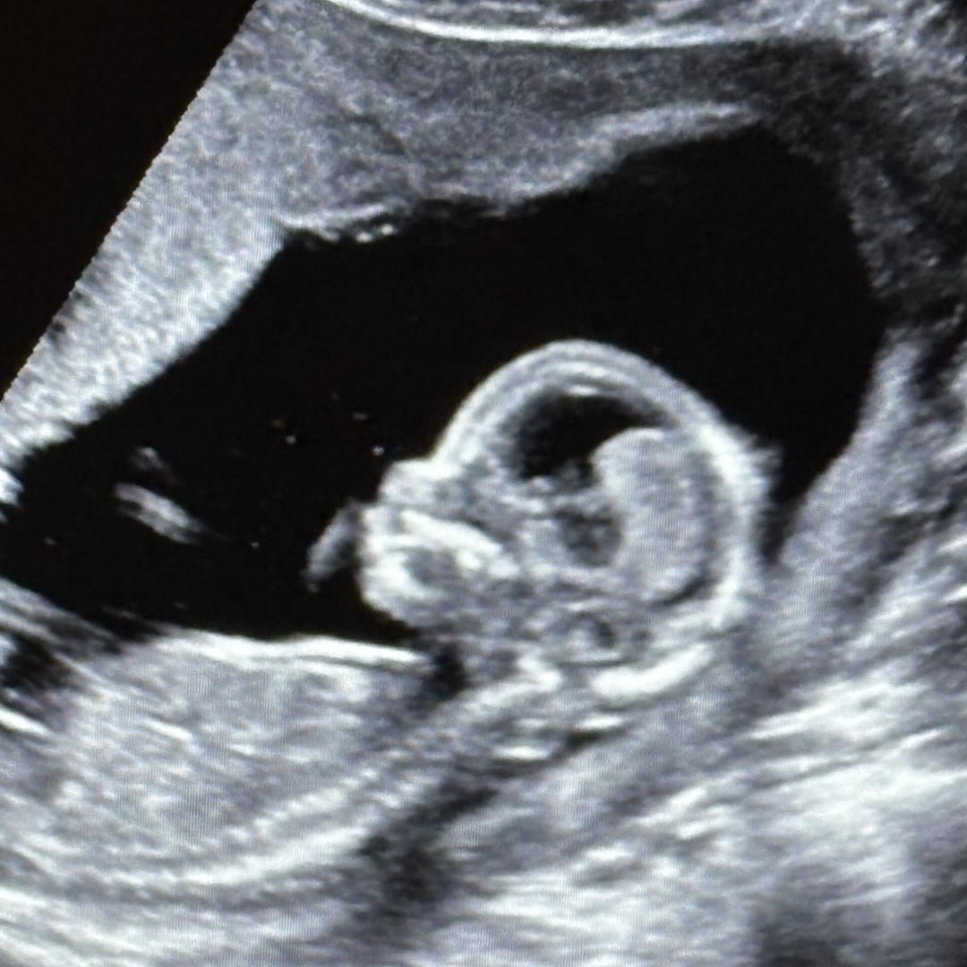 Photo shared by Rose for their Babylist baby registry.