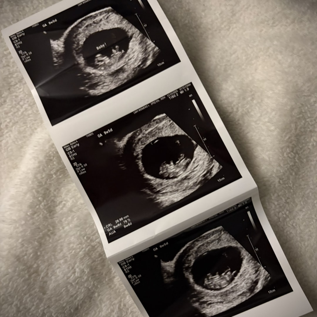 Photo shared by Rylea for their Babylist baby registry.