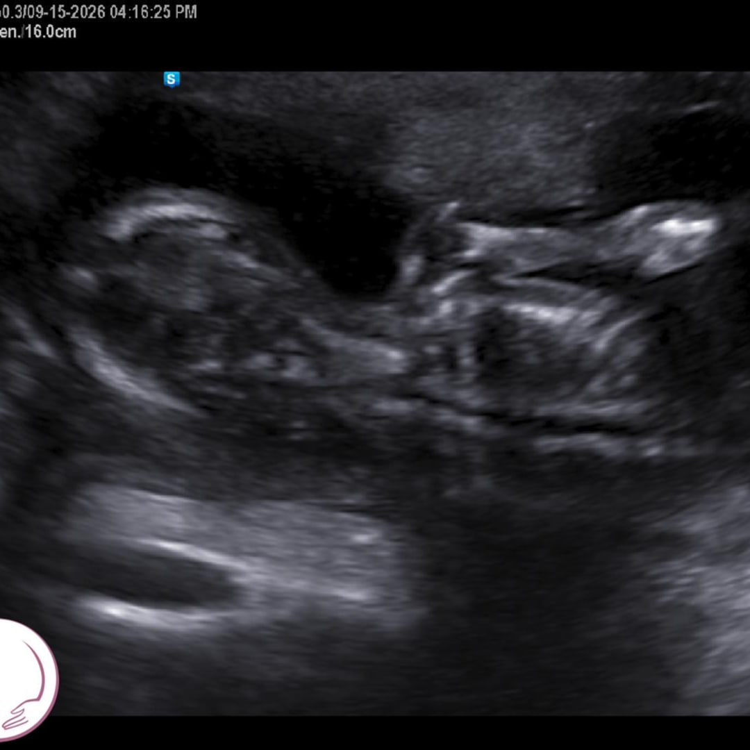 Photo shared by Ashley for their Babylist baby registry.