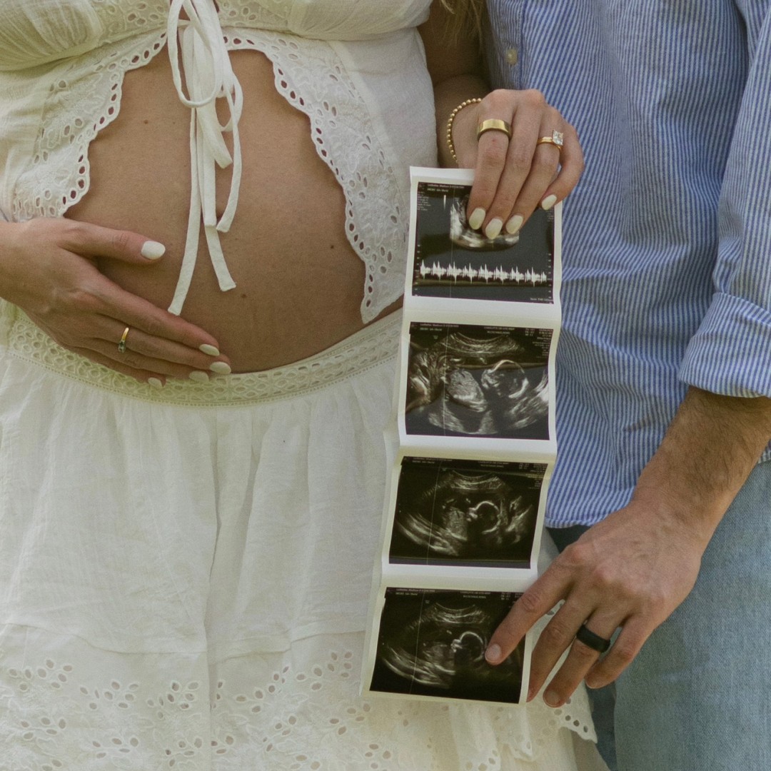 Photo shared by Madison for their Babylist baby registry.