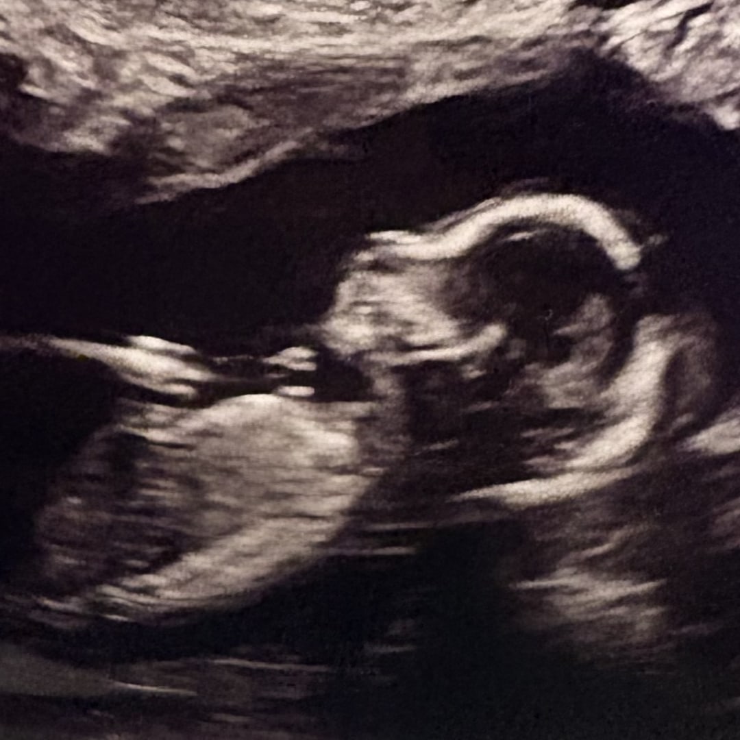 Photo shared by Angelina for their Babylist baby registry.