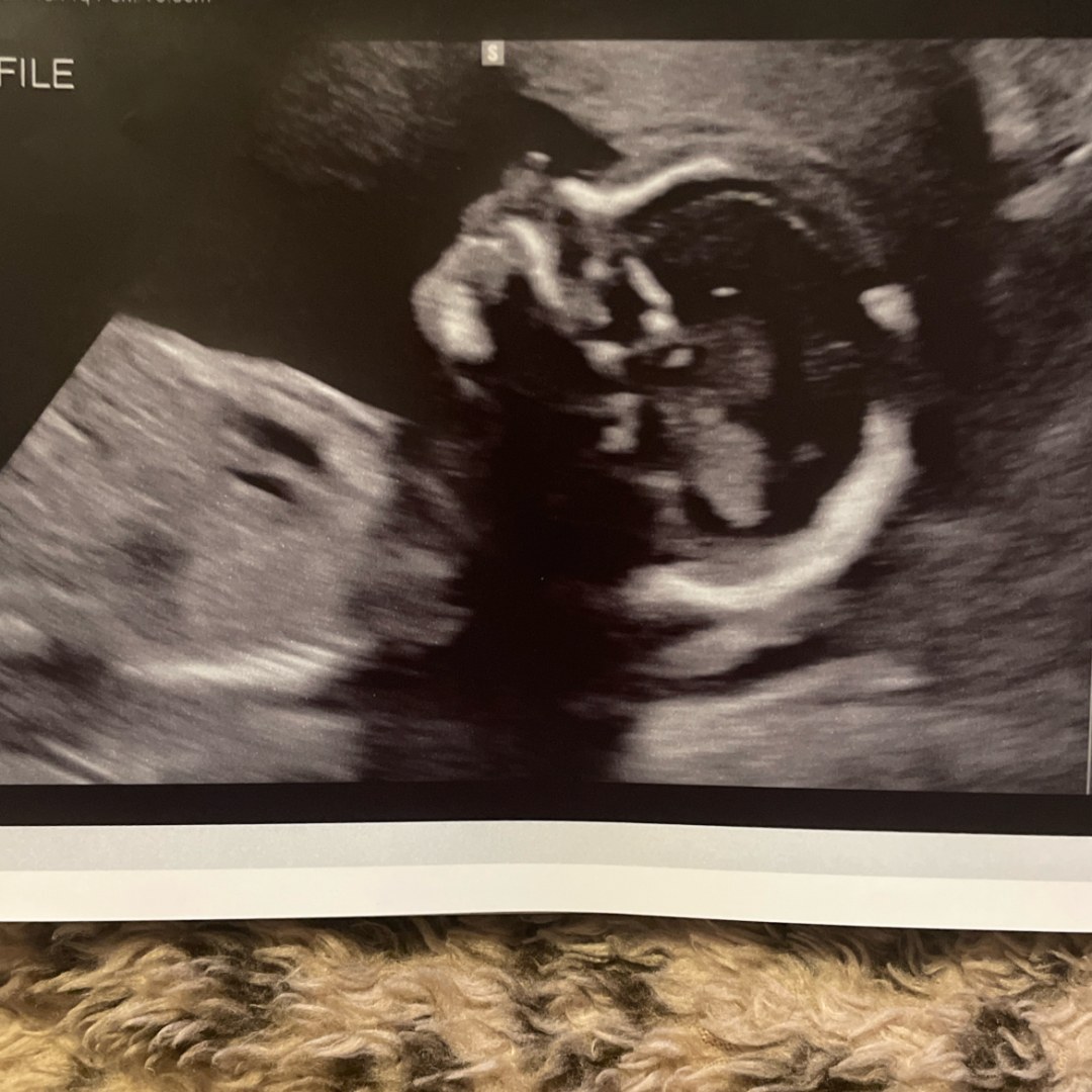 Photo shared by Amber for their Babylist baby registry.