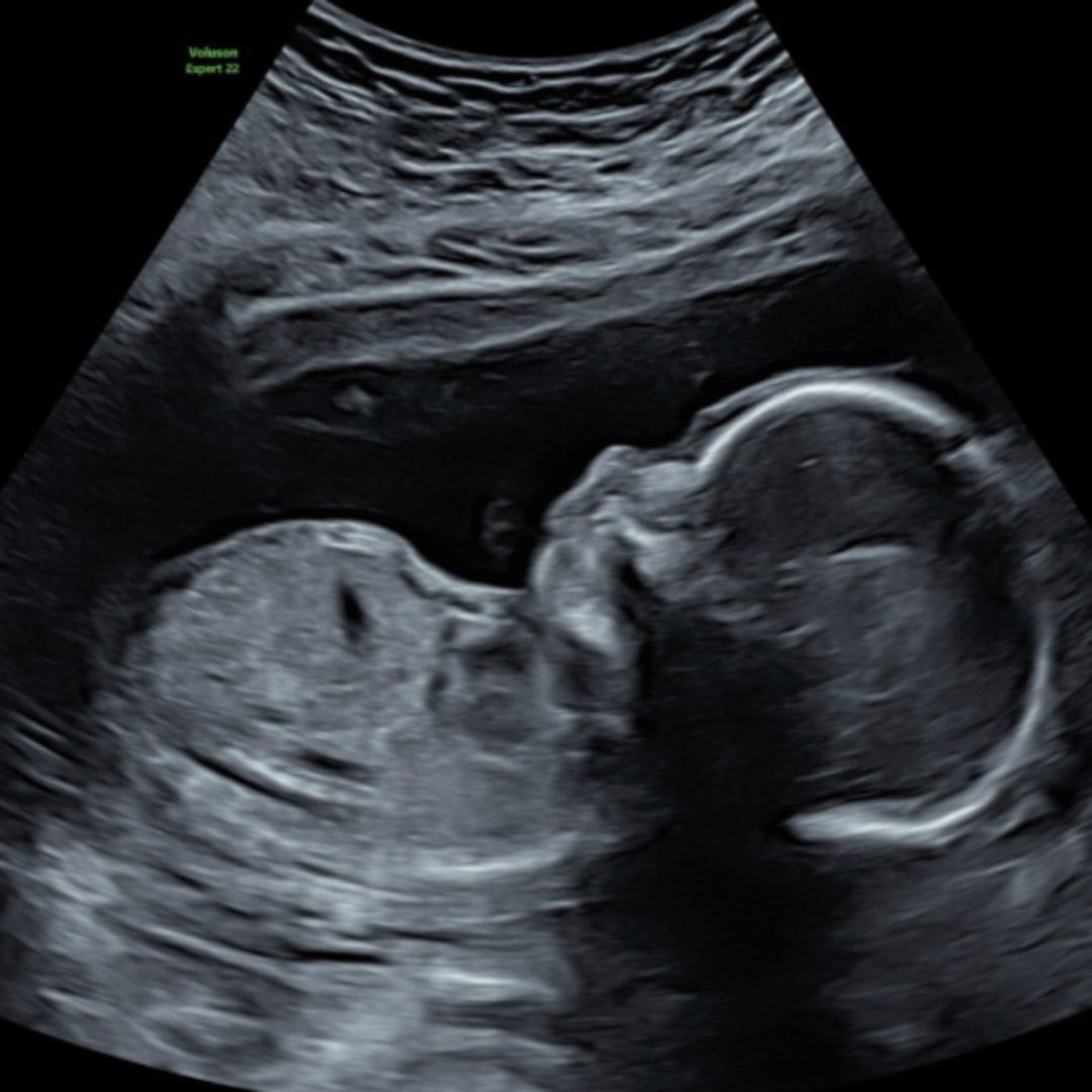 Photo shared by Cindy for their Babylist baby registry.
