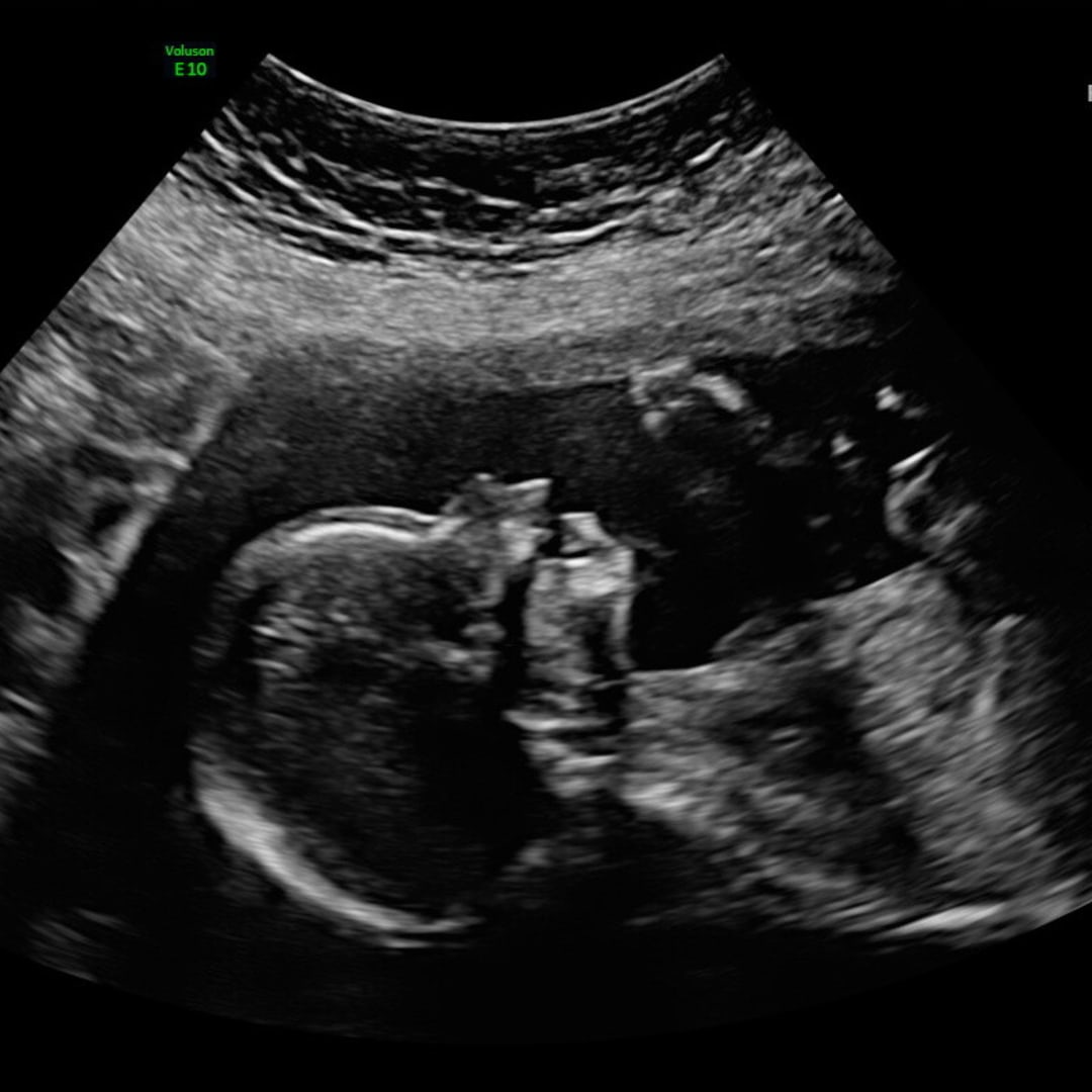 Photo shared by Britta for their Babylist baby registry.