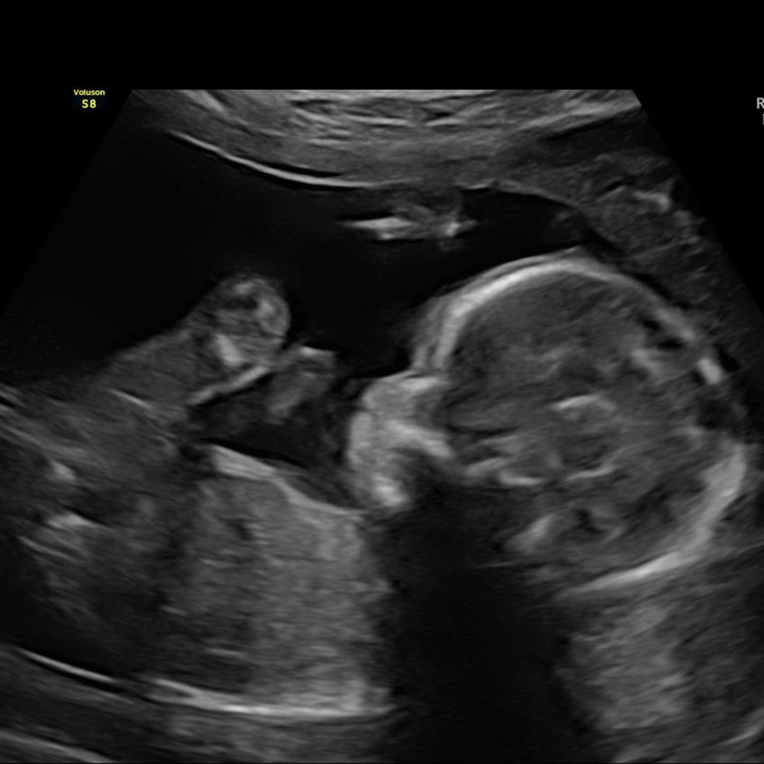 Photo shared by Heaven for their Babylist baby registry.