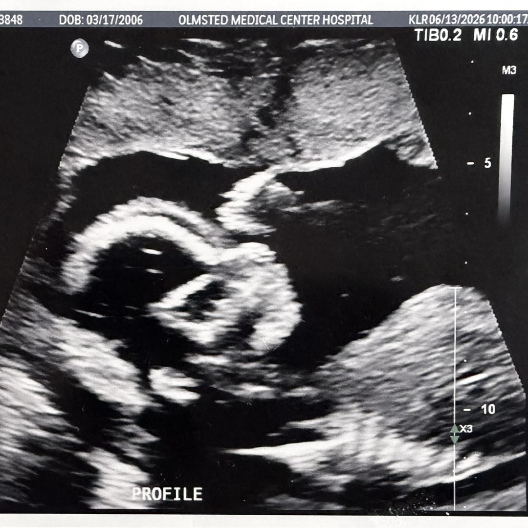 Photo shared by Melody for their Babylist baby registry.