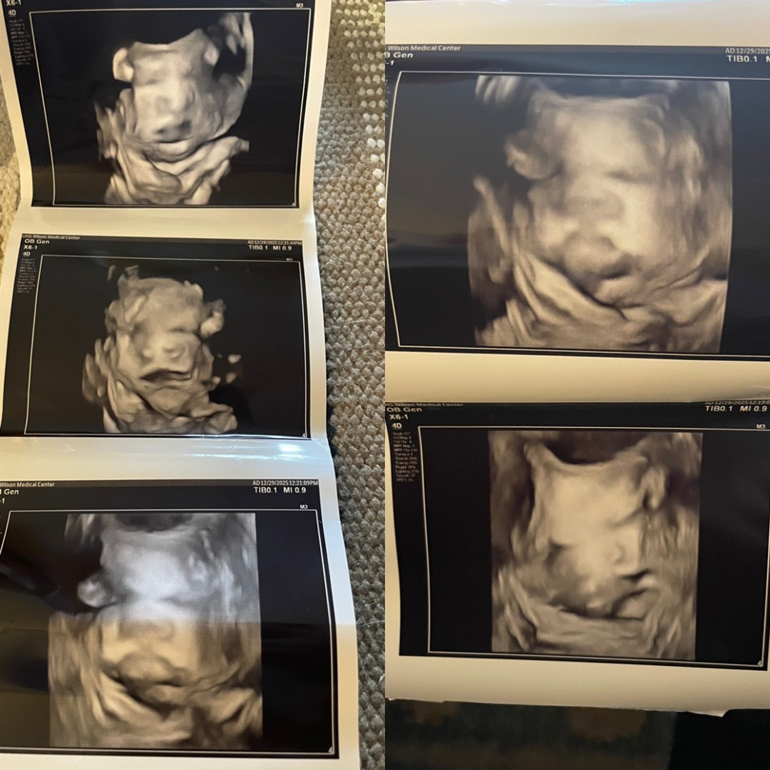 Photo shared by Alexandrea for their Babylist baby registry.