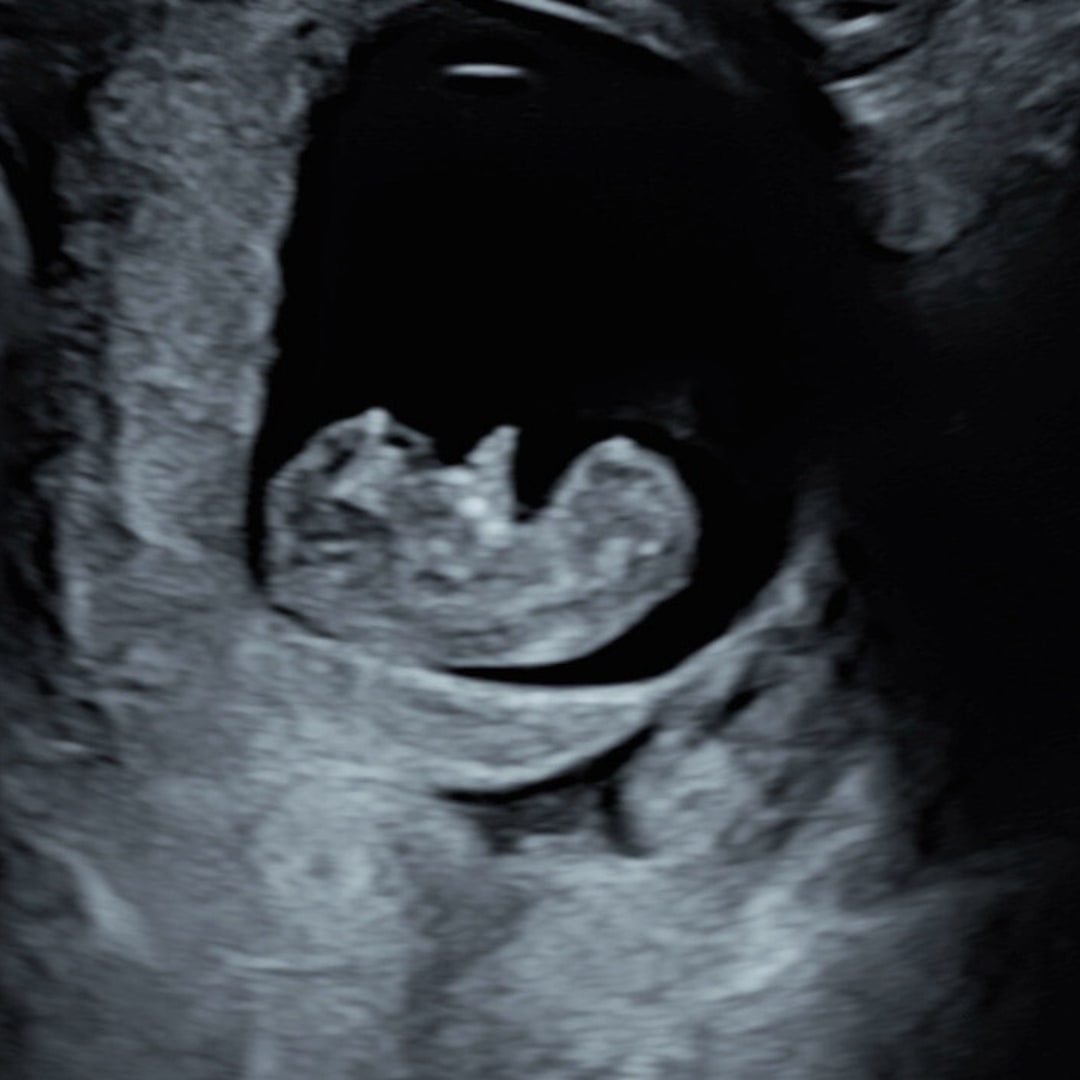 Photo shared by Sky for their Babylist baby registry.