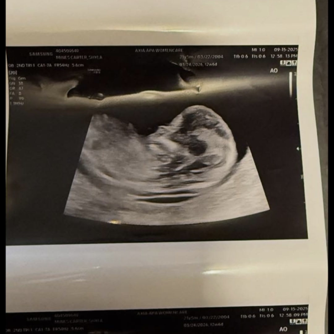 Photo shared by Shyla for their Babylist baby registry.