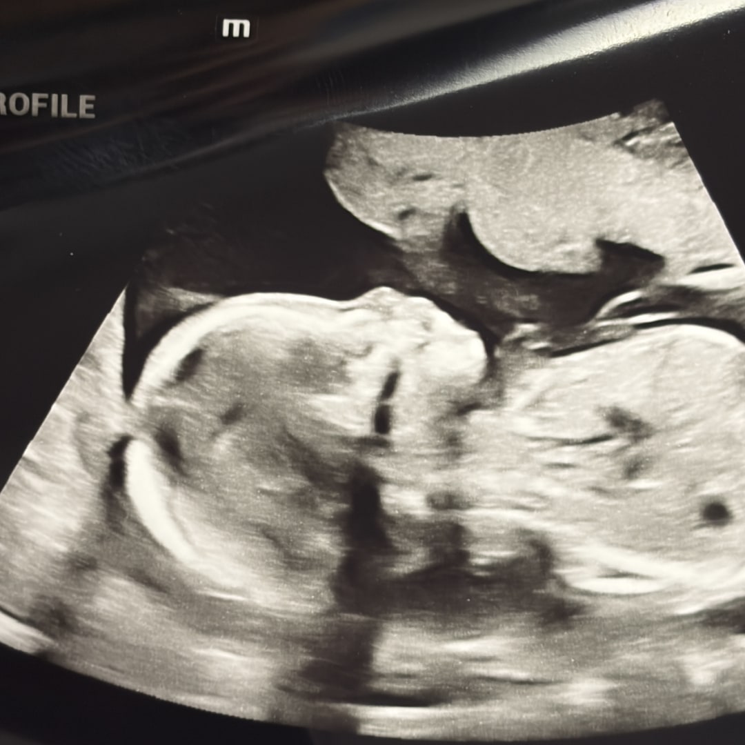Photo shared by Hailee for their Babylist baby registry.