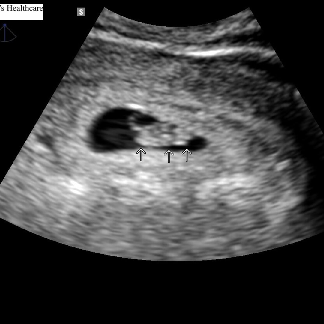 Photo shared by Drake for their Babylist baby registry.