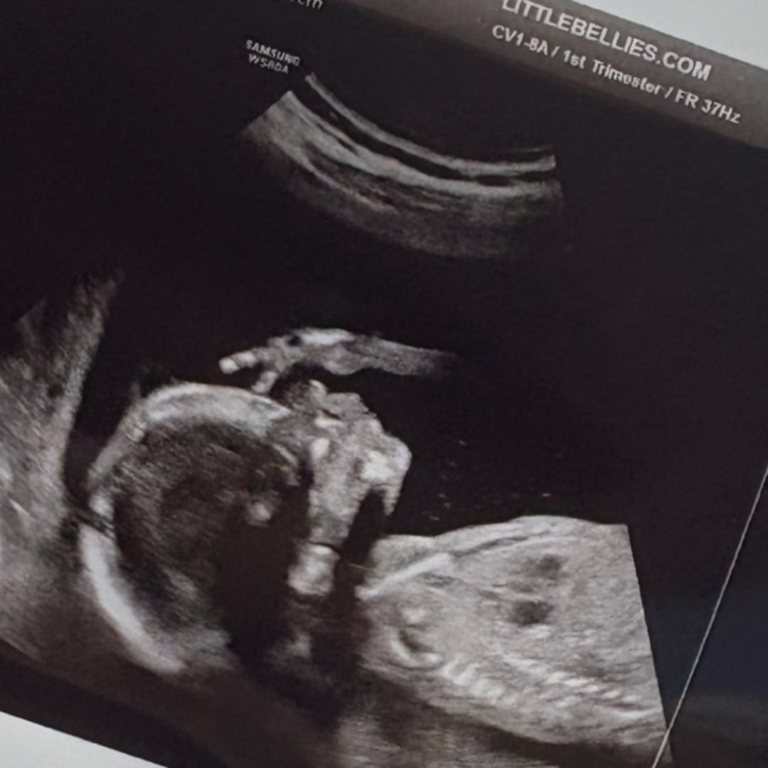 Photo shared by Alizia for their Babylist baby registry.