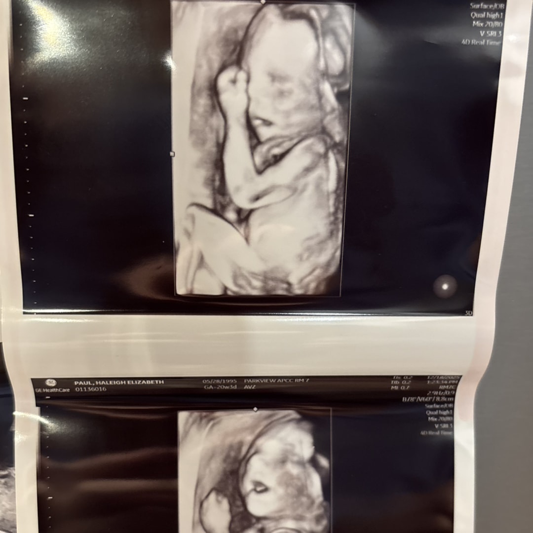 Photo shared by Haleigh for their Babylist baby registry.