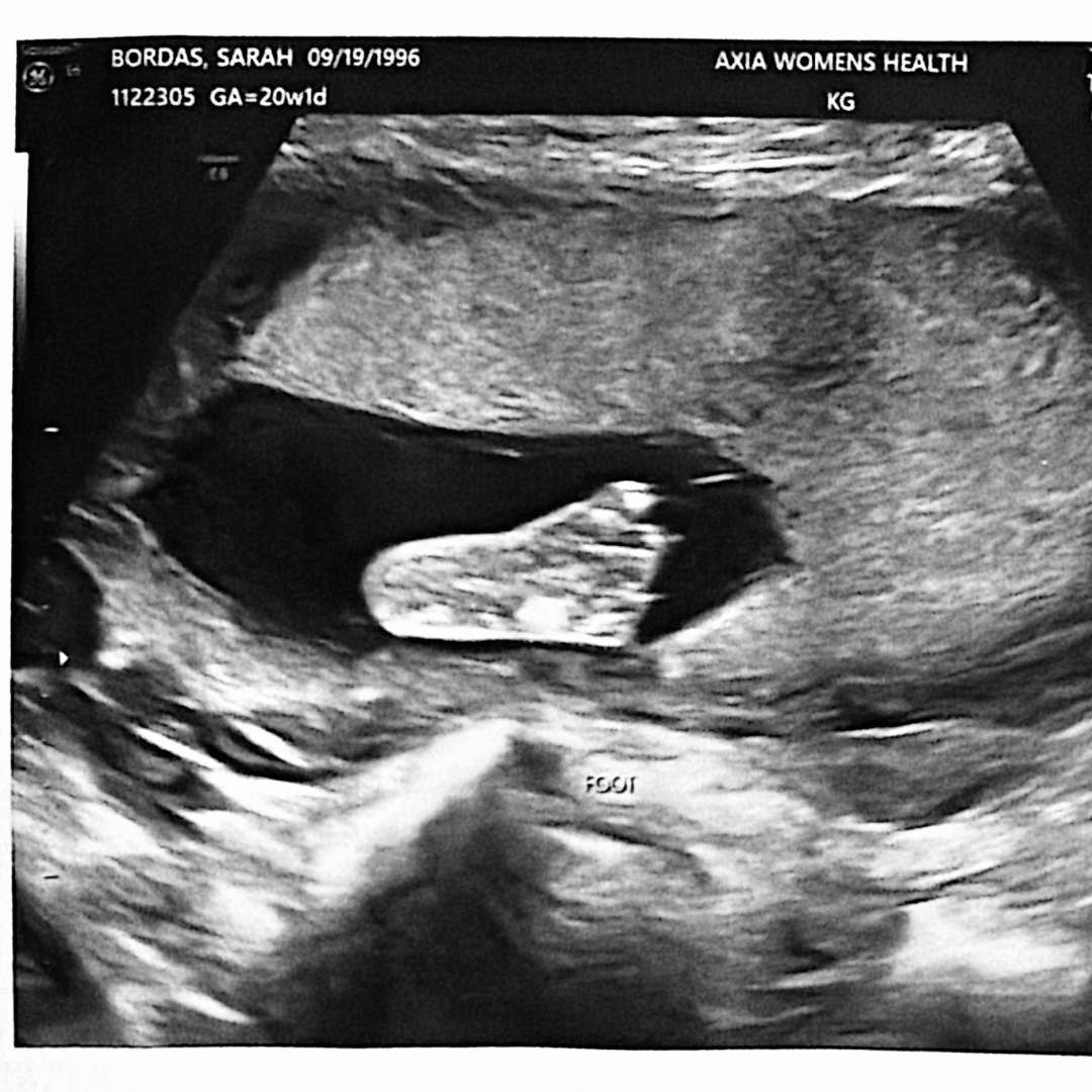 Photo shared by Sarah for their Babylist baby registry.