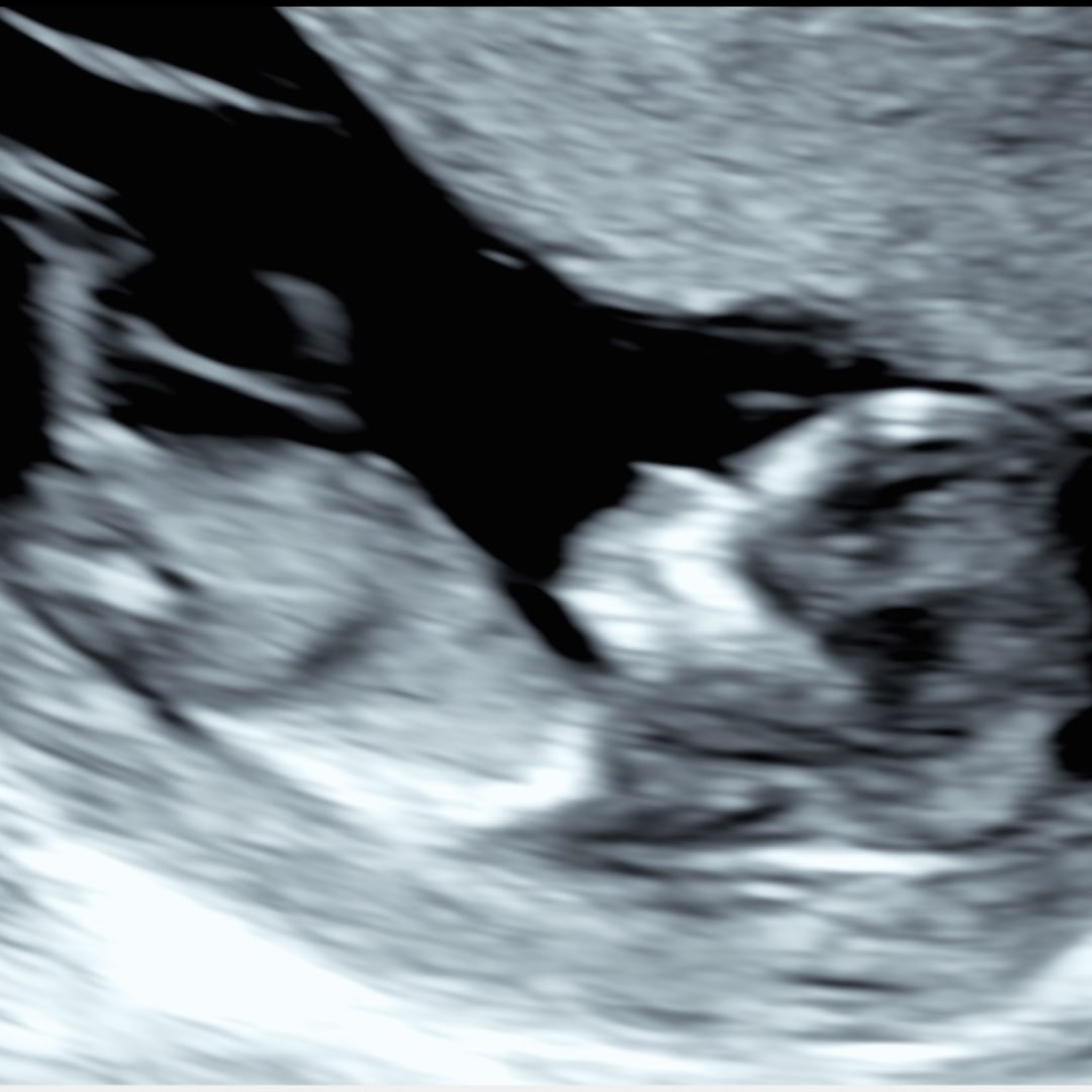 Photo shared by Aspin for their Babylist baby registry.