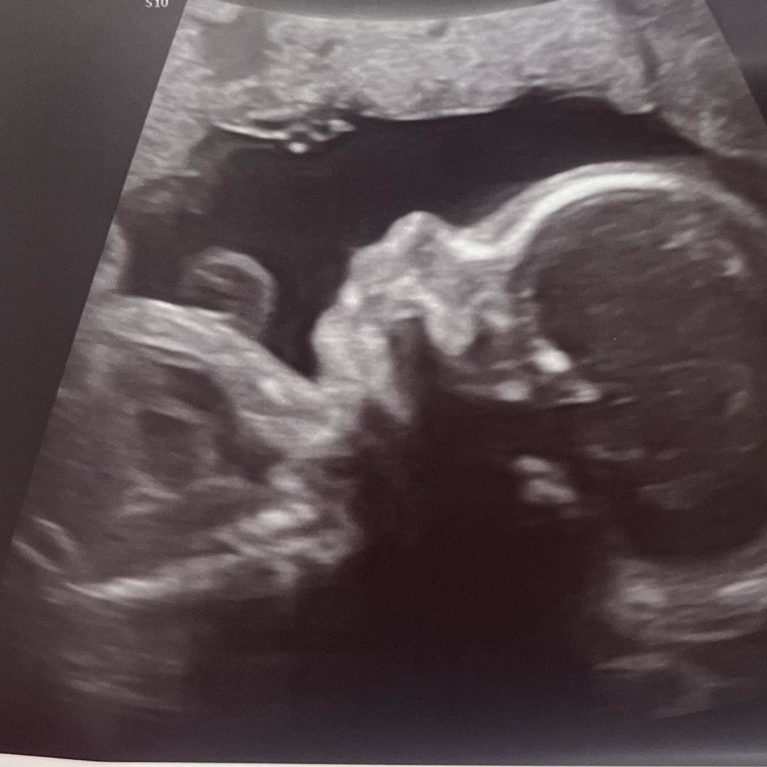 Photo shared by Brenna for their Babylist baby registry.