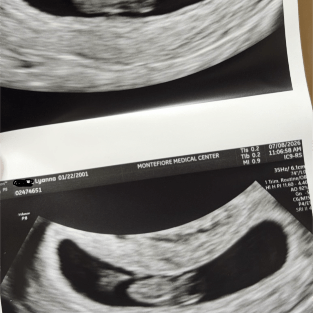 Photo shared by Caeleb for their Babylist baby registry.