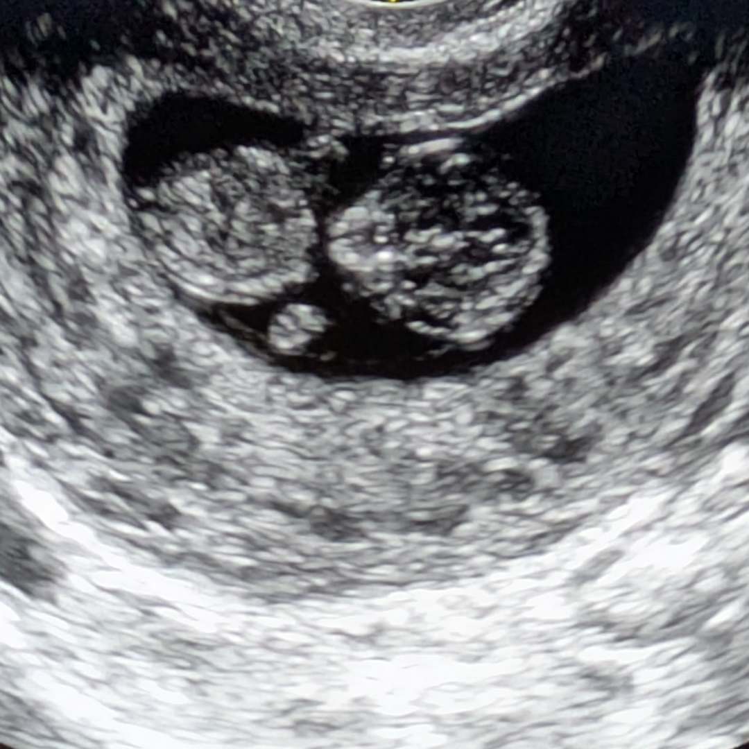 Photo shared by Jasmine for their Babylist baby registry.