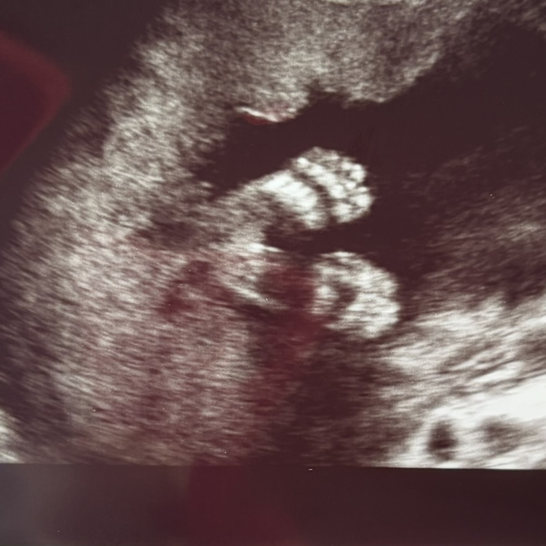 Photo shared by Jenn for their Babylist baby registry.