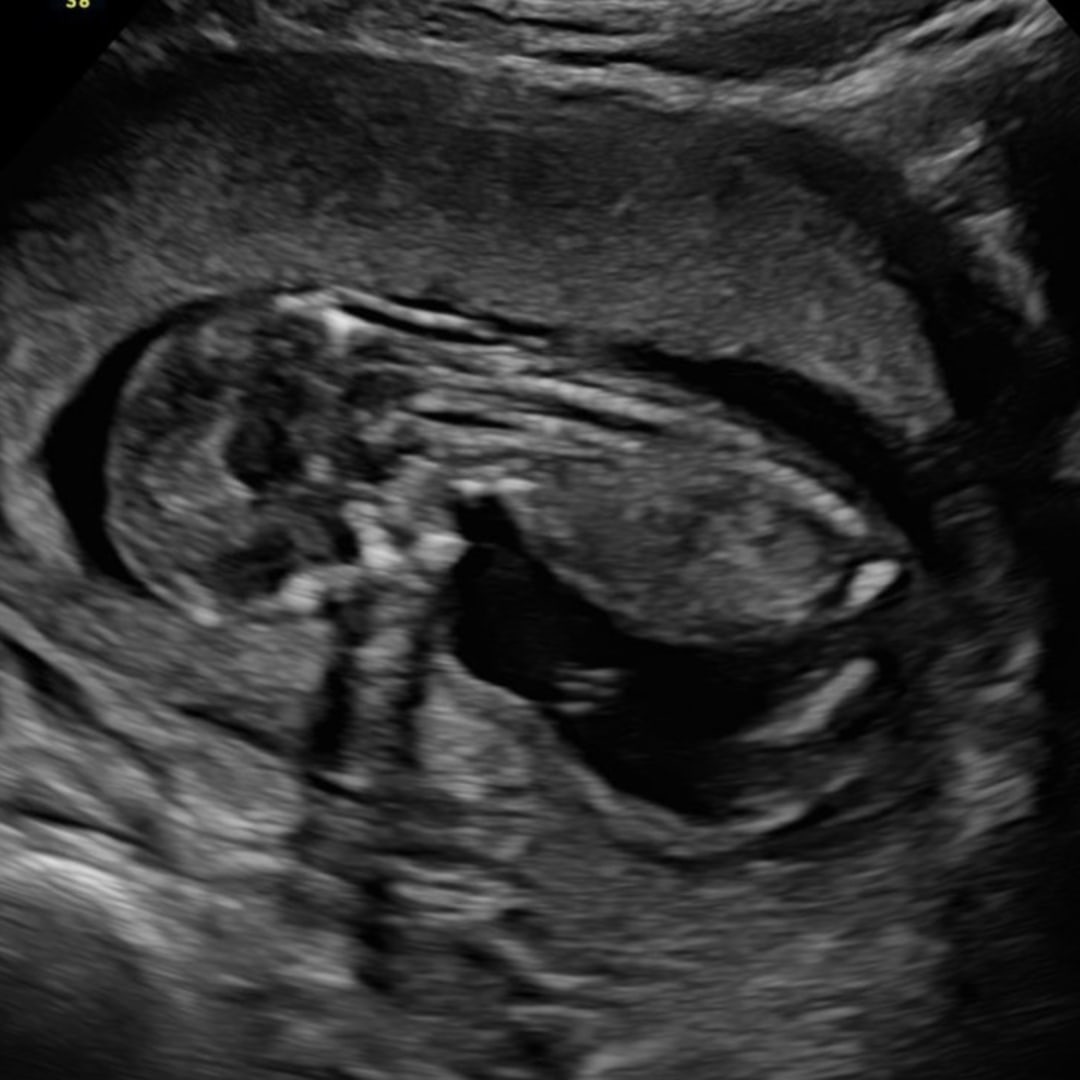 Photo shared by Hayleigh for their Babylist baby registry.