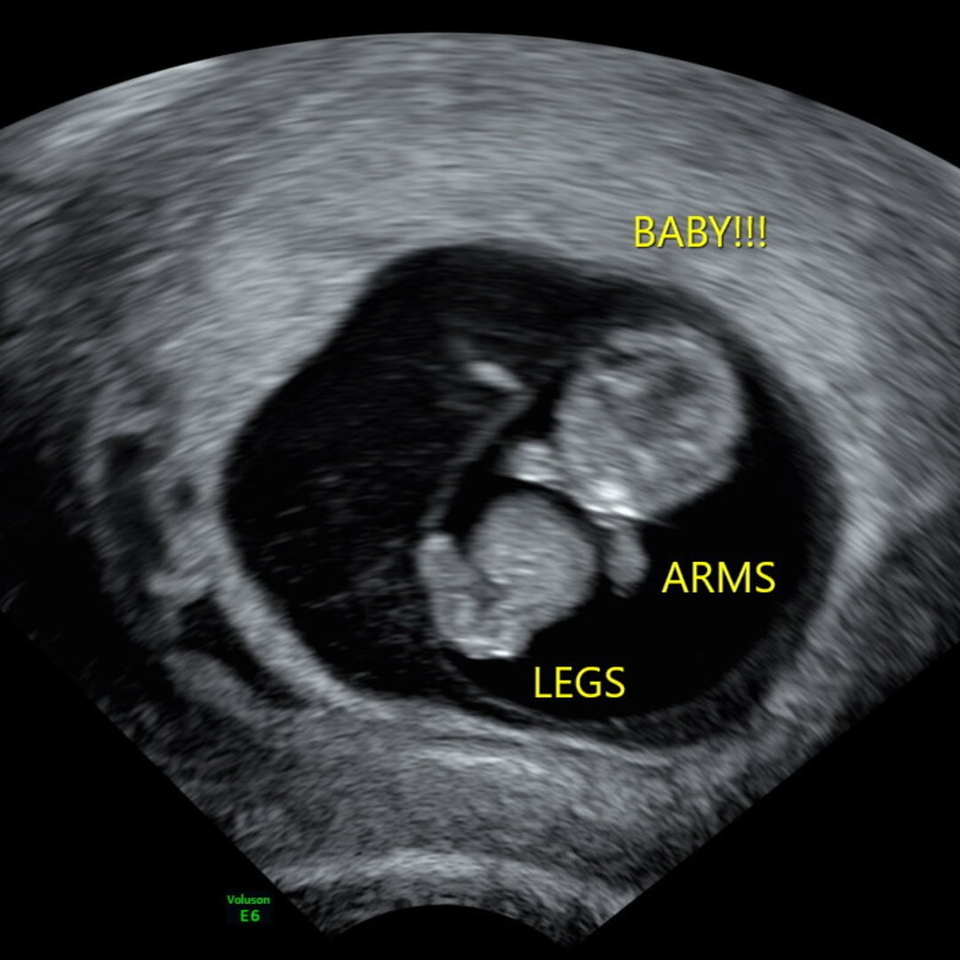 Photo shared by Monica for their Babylist baby registry.