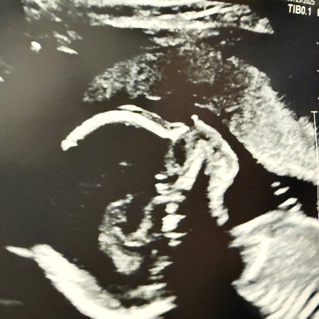 Photo shared by Lauren for their Babylist baby registry.