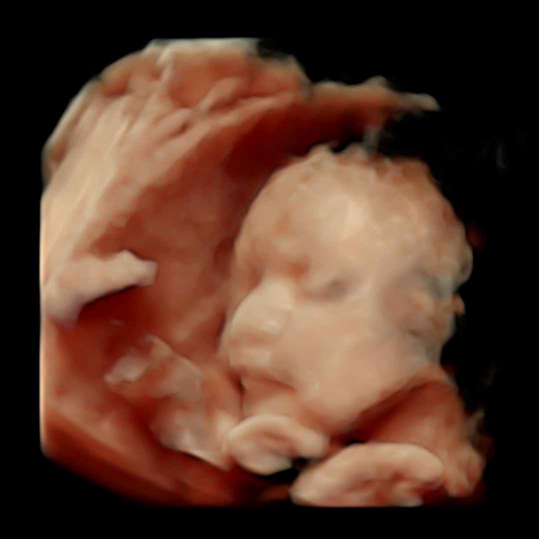 Photo shared by Kaitlin for their Babylist baby registry.