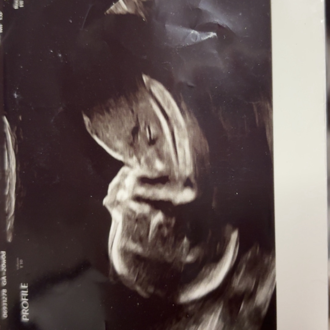 Photo shared by Elizabeth for their Babylist baby registry.