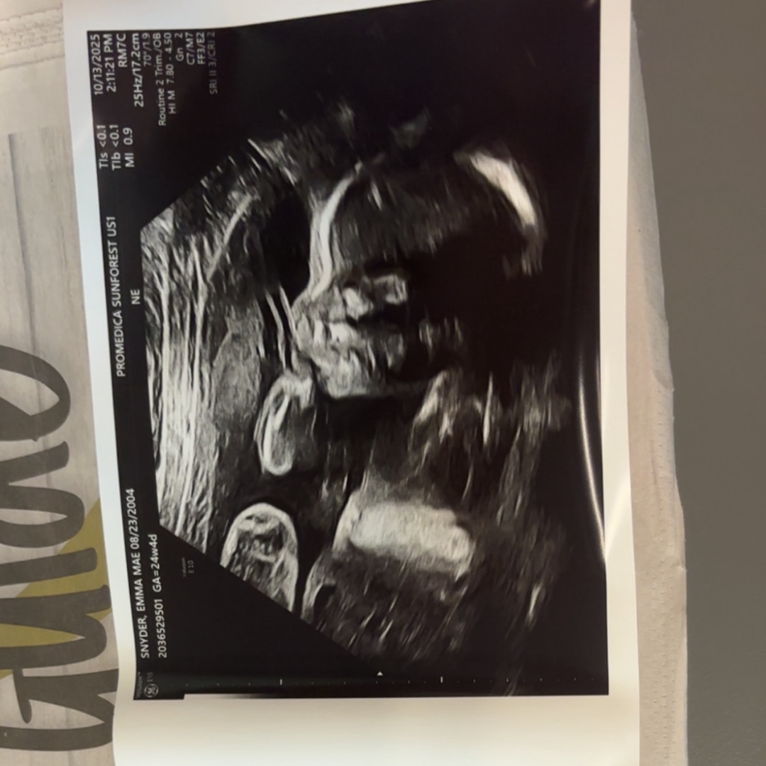 Photo shared by Emma for their Babylist baby registry.