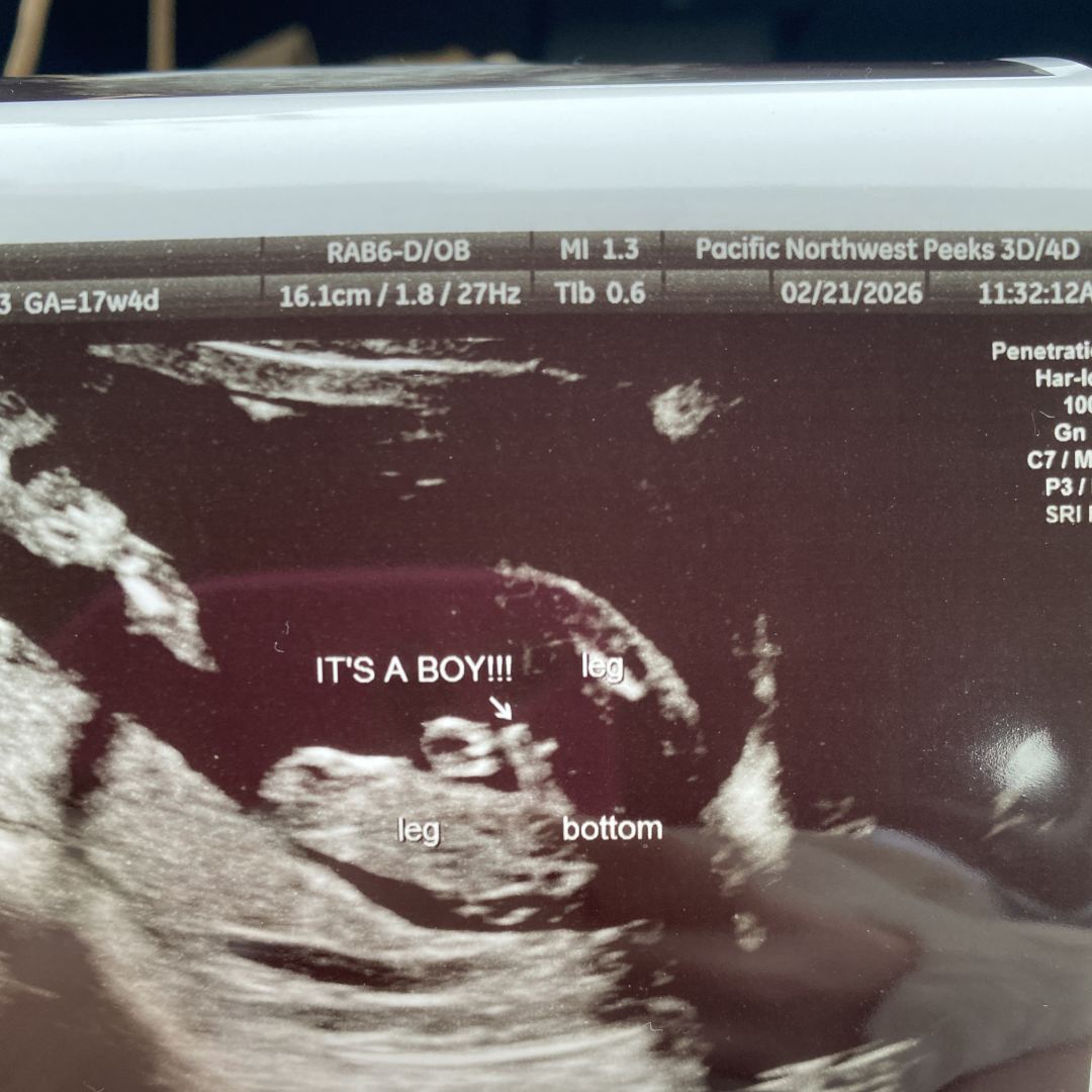 Photo shared by Tiffany for their Babylist baby registry.