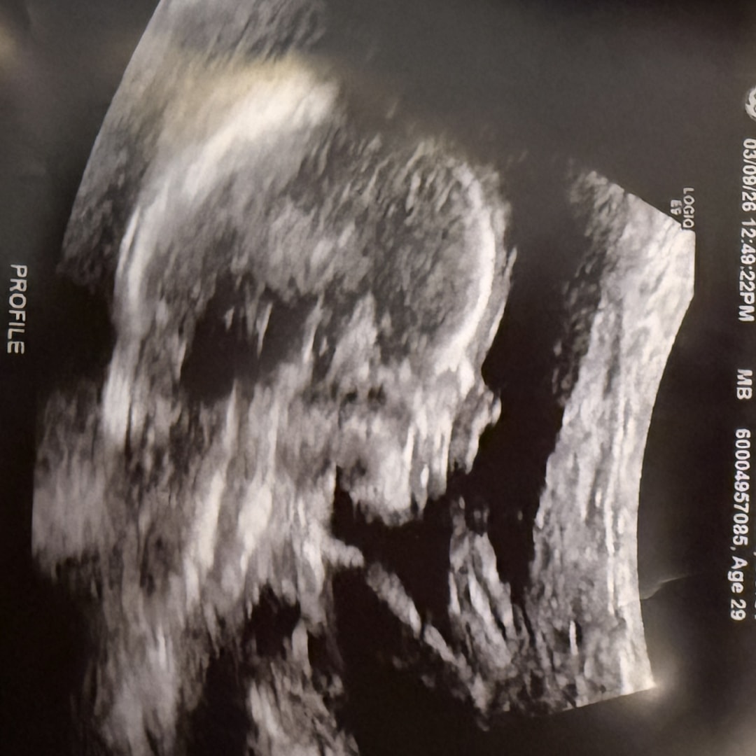 Photo shared by Cora for their Babylist baby registry.