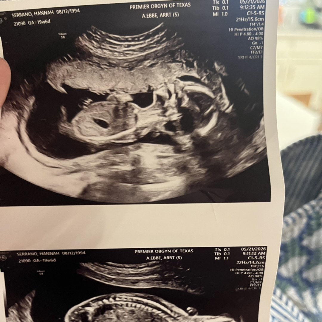 Photo shared by Hannah for their Babylist baby registry.