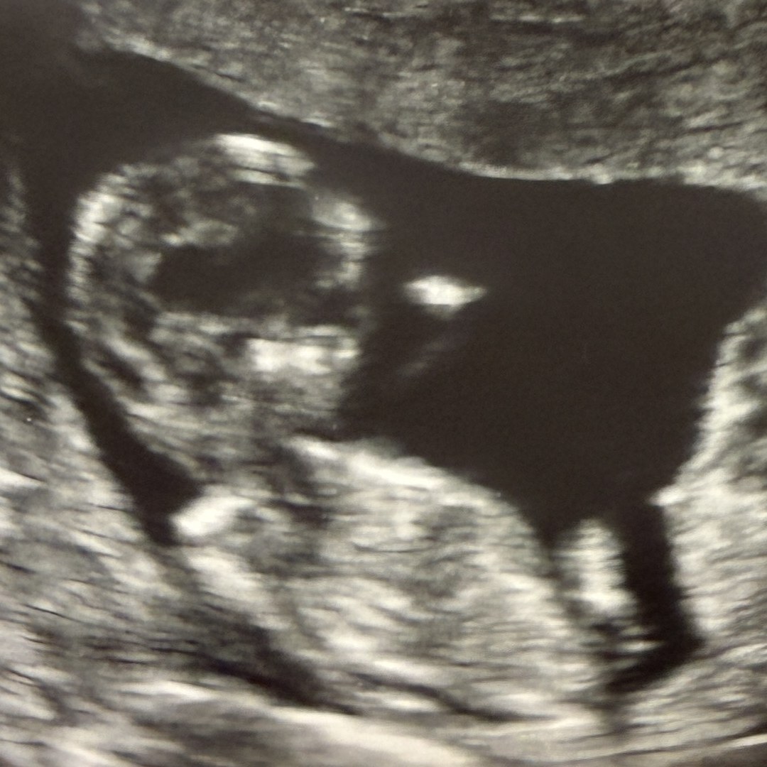 Photo shared by Addison for their Babylist baby registry.