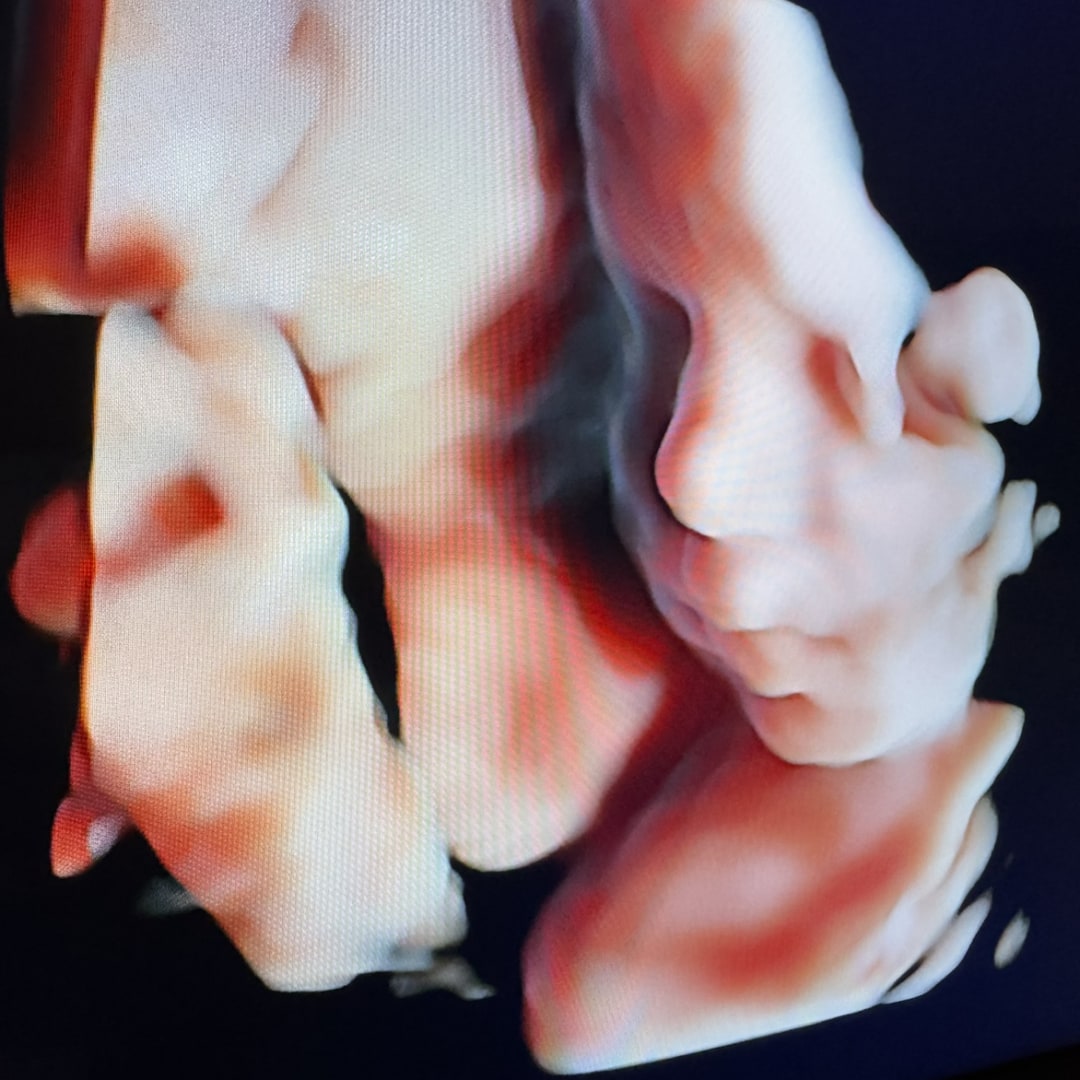 Photo shared by Hailey for their Babylist baby registry.