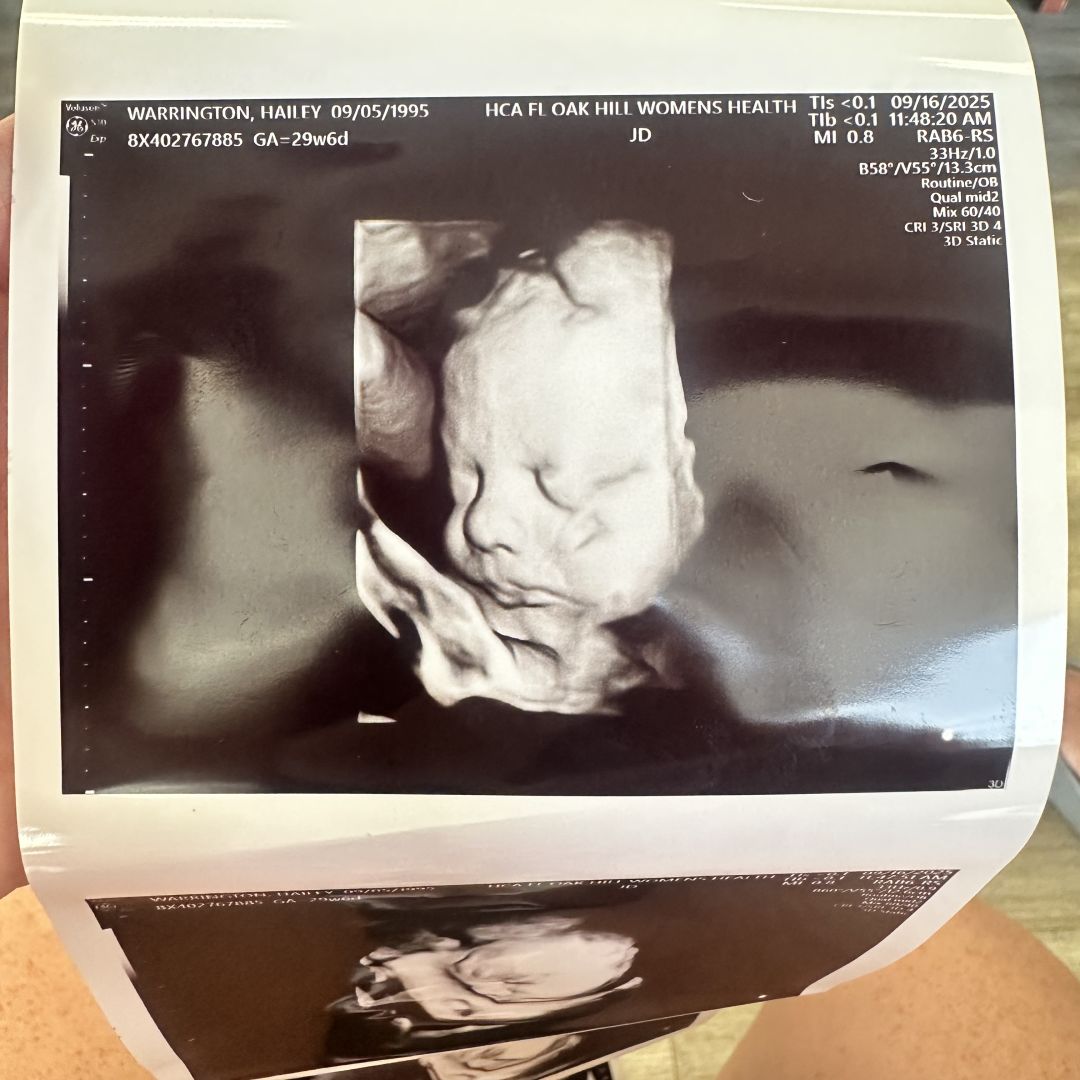 Photo shared by Hailey for their Babylist baby registry.