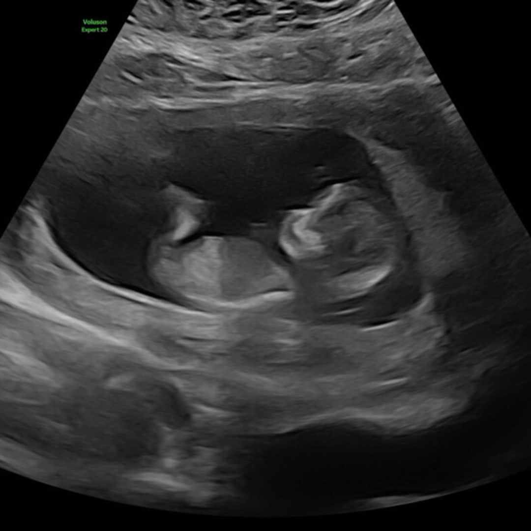 Photo shared by Cynthia for their Babylist baby registry.