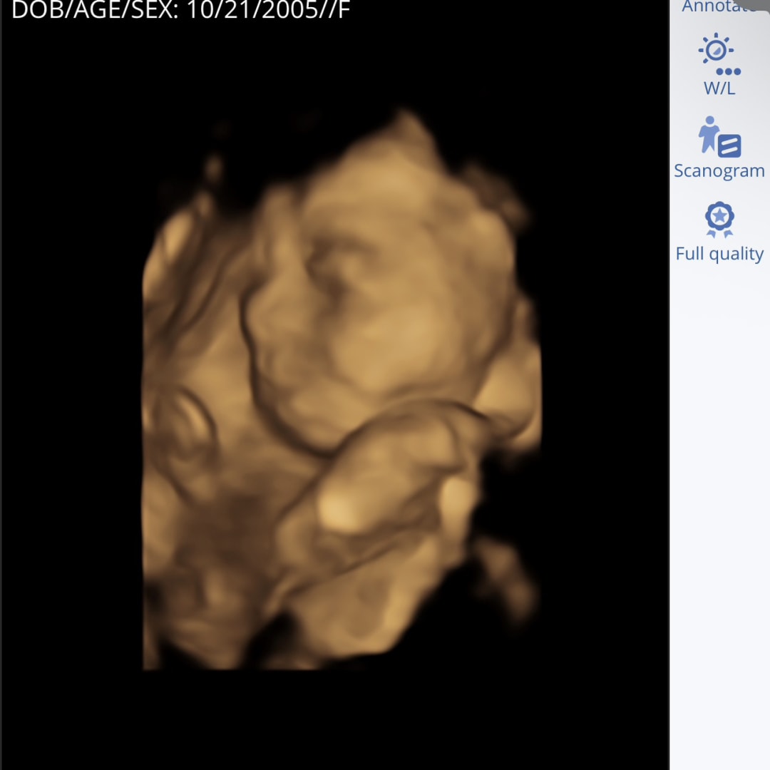 Photo shared by Marhia for their Babylist baby registry.