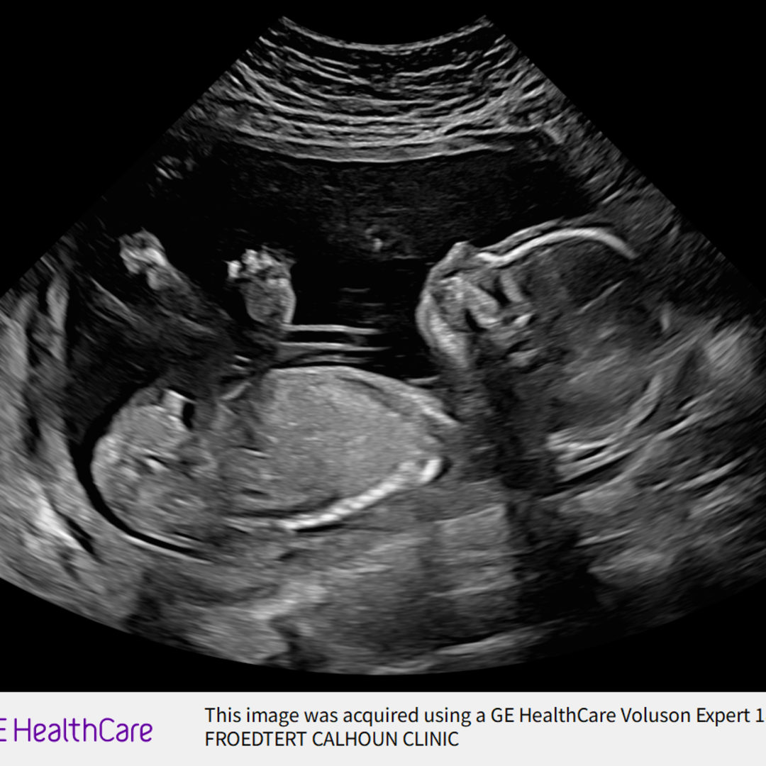 Photo shared by Casey for their Babylist baby registry.