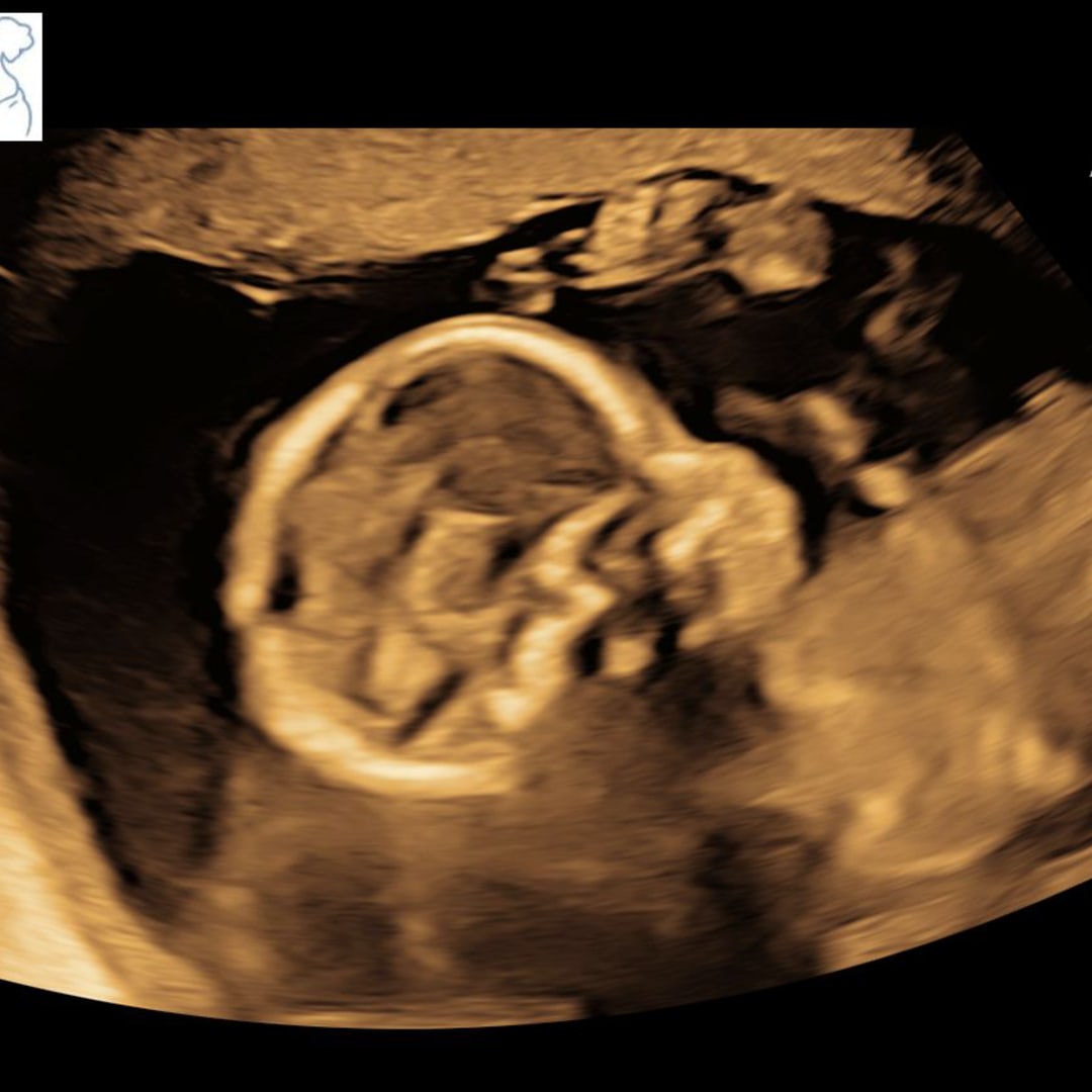 Photo shared by JANEXY for their Babylist baby registry.