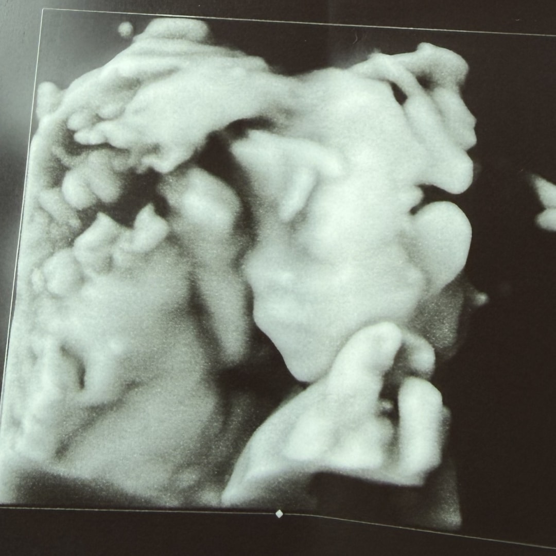 Photo shared by Tyler-Lynne for their Babylist baby registry.