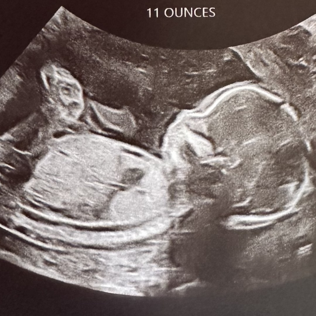 Photo shared by Jennifer for their Babylist baby registry.