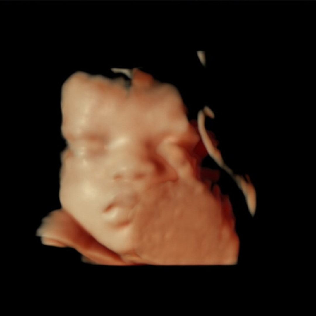 Photo shared by Adoni for their Babylist baby registry.