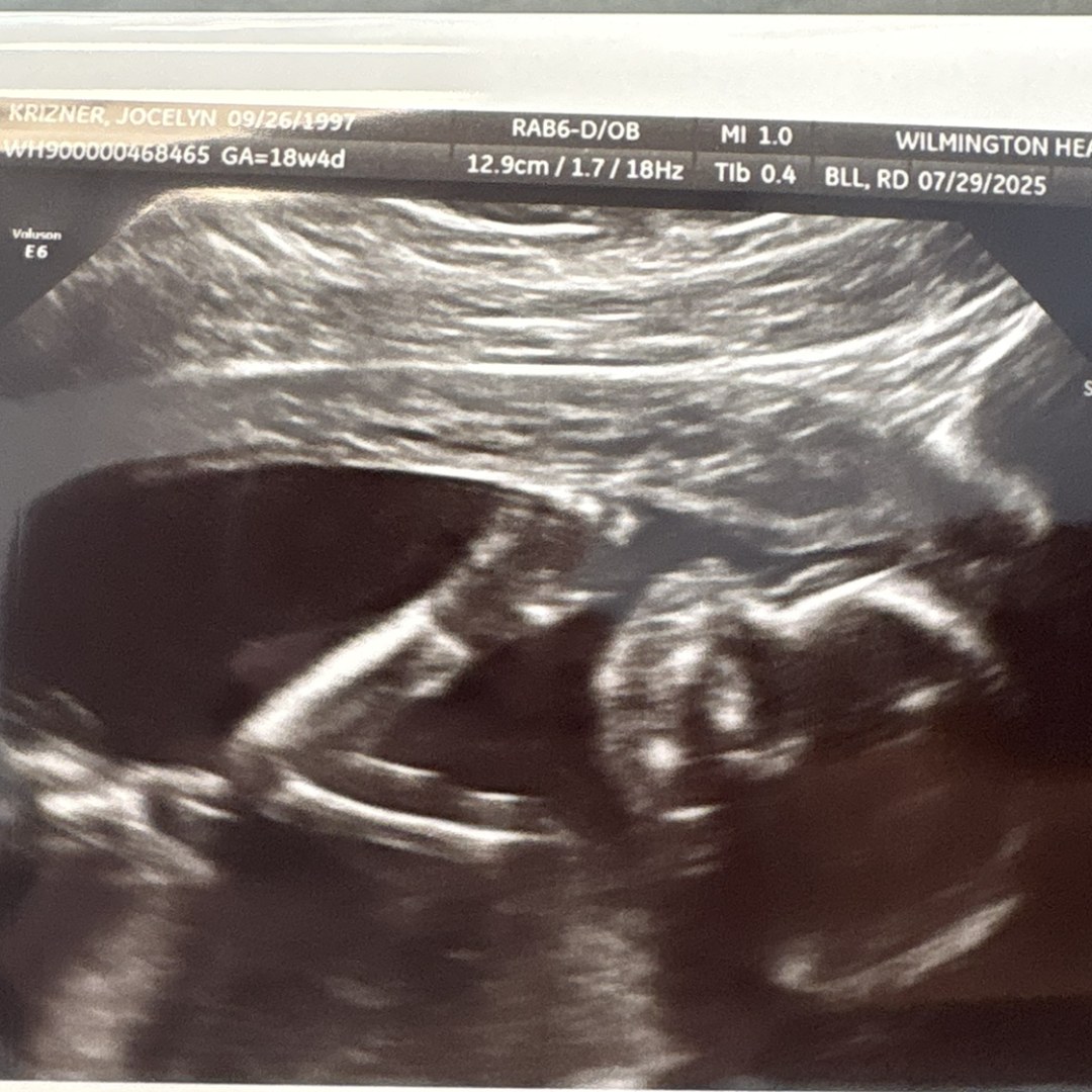 Photo shared by Jocelyn for their Babylist baby registry.