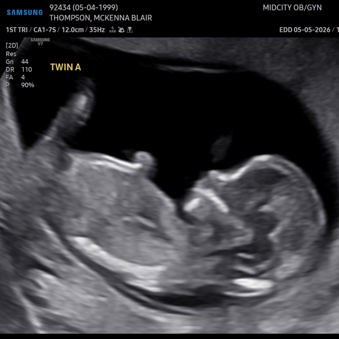 Photo shared by McKenna for their Babylist baby registry.