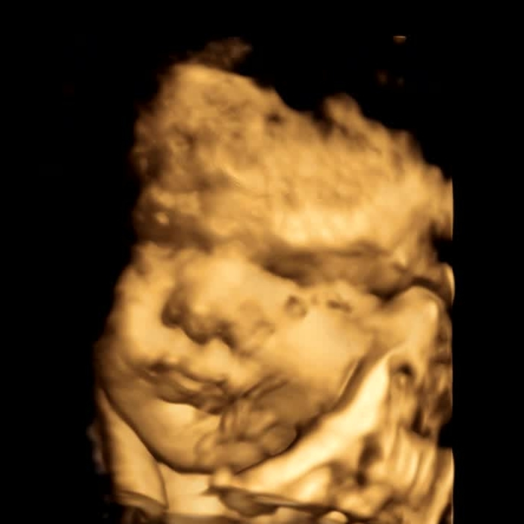 Photo shared by Hannah for their Babylist baby registry.